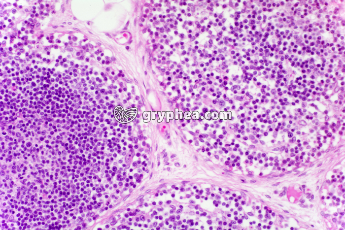 Thymus x100 - gryphea.org